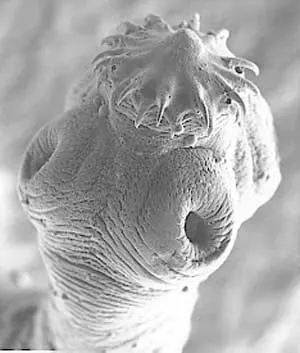 Taenia solium