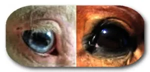 eye